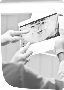 Reviewing a digital clear aligner treatment plan