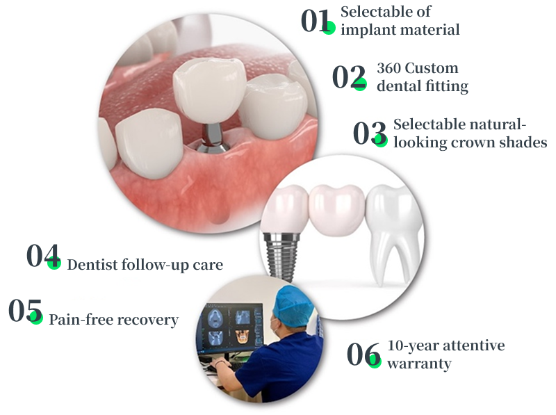 Dental implant post and crown held by gloved hands.