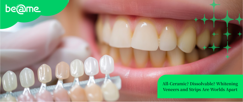 [Smile Guide] So Many Options for Teeth Whitening Veneers: A Step-by-Step Guide to 3 Types of Veneers—Essential Facts Before Getting Veneers + Prices