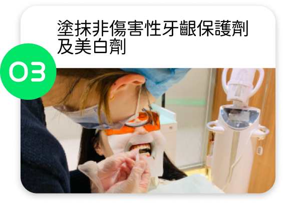 開始藍光美白前，自有光牙醫會塗抹非傷害性牙齦保護劑及美白劑。