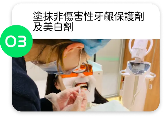 開始藍光美白前，自有光牙醫會塗抹非傷害性牙齦保護劑及美白劑。