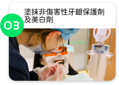 開始藍光美白前，自有光牙醫會塗抹非傷害性牙齦保護劑及美白劑。