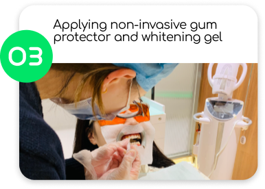 開始藍光美白前，自有光牙醫會塗抹非傷害性牙齦保護劑及美白劑。