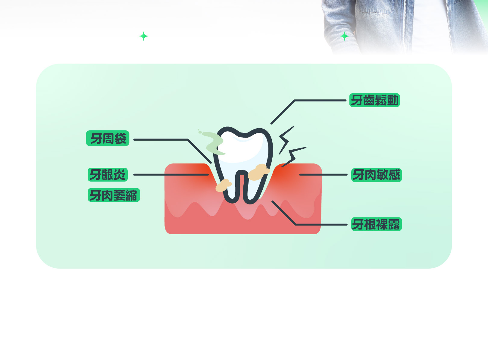 牙周炎的症状表现 常见的牙周炎有哪些表现 - 学堂在线健康网