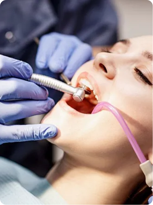 什麼是專業洗牙 (Dental Scaling)