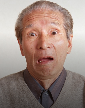 缺牙引發臉腮歪